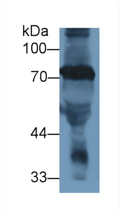 Polyclonal Antibody to Transferrin (TF)