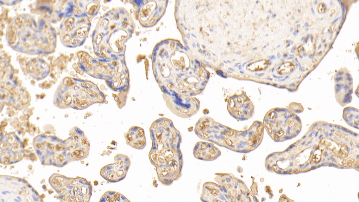 Polyclonal Antibody to Transferrin (TF)