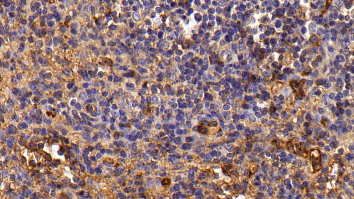 Polyclonal Antibody to Transferrin (TF)