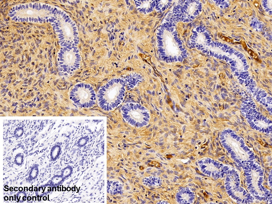 Polyclonal Antibody to Transferrin (TF)