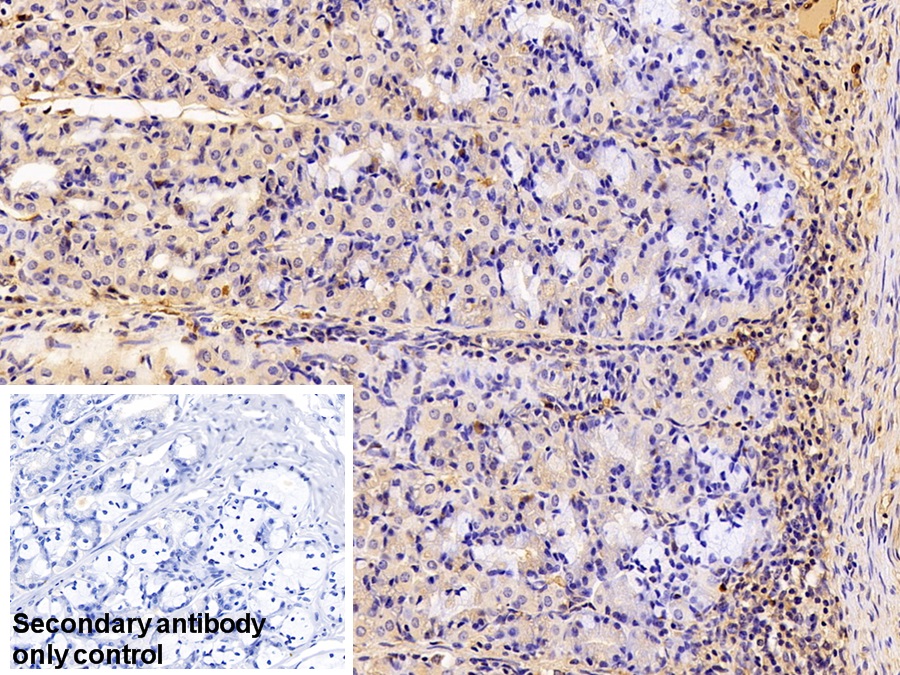 Polyclonal Antibody to Transferrin (TF)