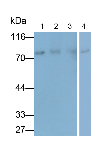 Polyclonal Antibody to Transferrin (TF)