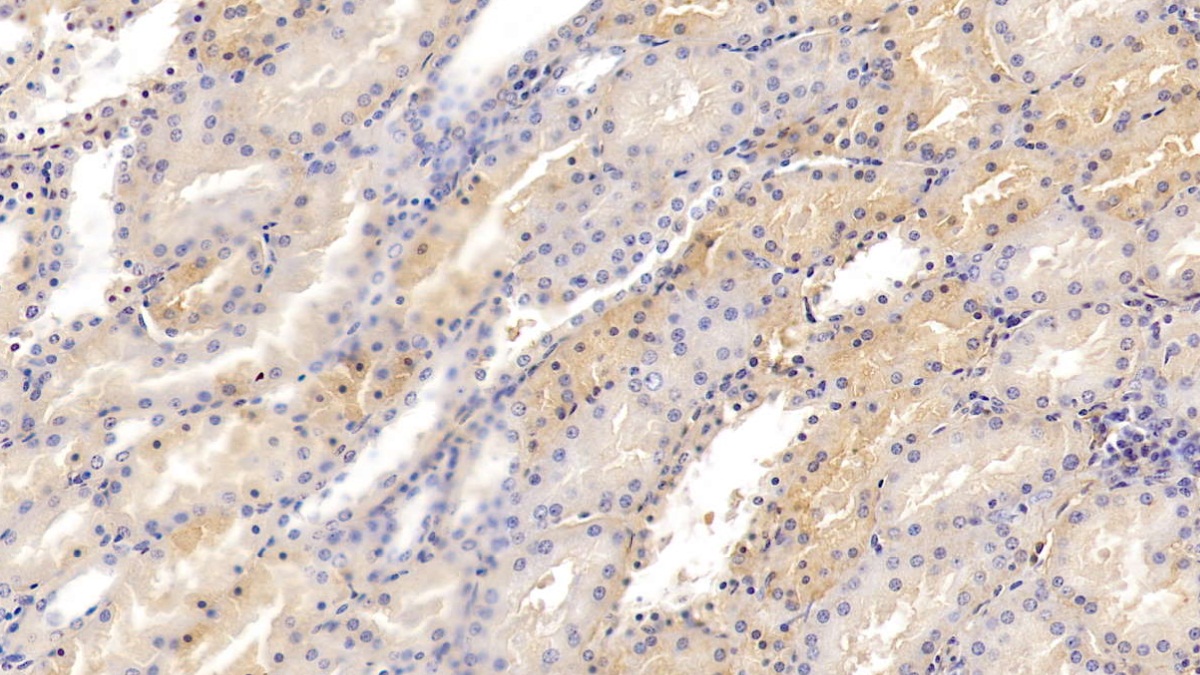 Polyclonal Antibody to Transferrin (TF)