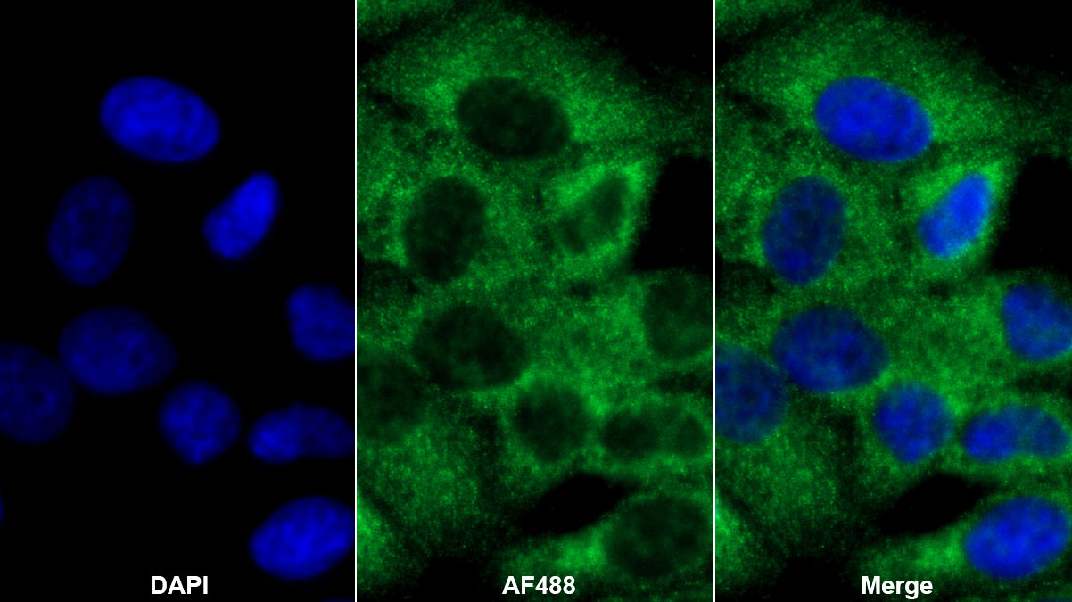 Polyclonal Antibody to Transferrin (TF)