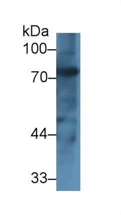 Polyclonal Antibody to Transferrin (TF)