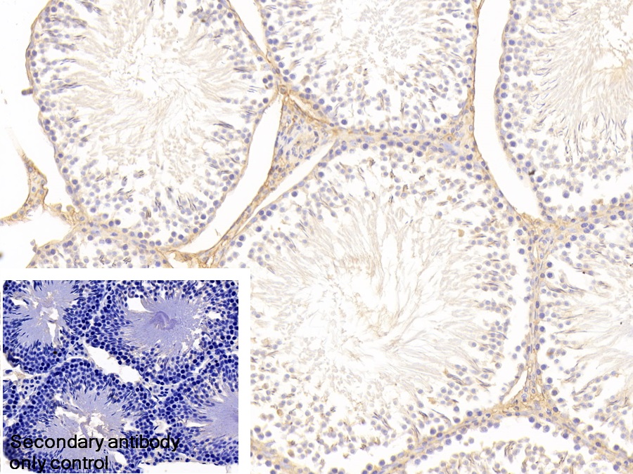 Polyclonal Antibody to Transferrin (TF)