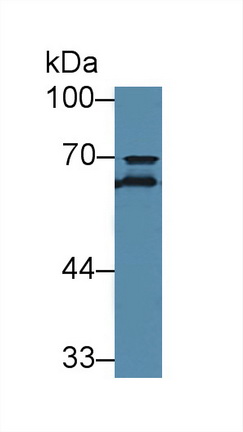 Polyclonal Antibody to Transferrin (TF)