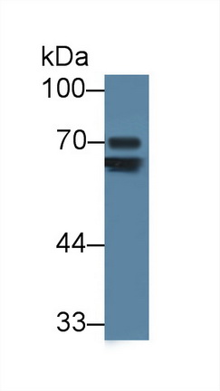 Polyclonal Antibody to Transferrin (TF)