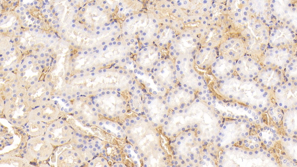 Polyclonal Antibody to Transferrin (TF)