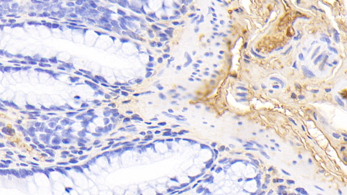 Polyclonal Antibody to Transferrin (TF)