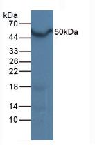 Polyclonal Antibody to Liver X Receptor Alpha (LXRa)