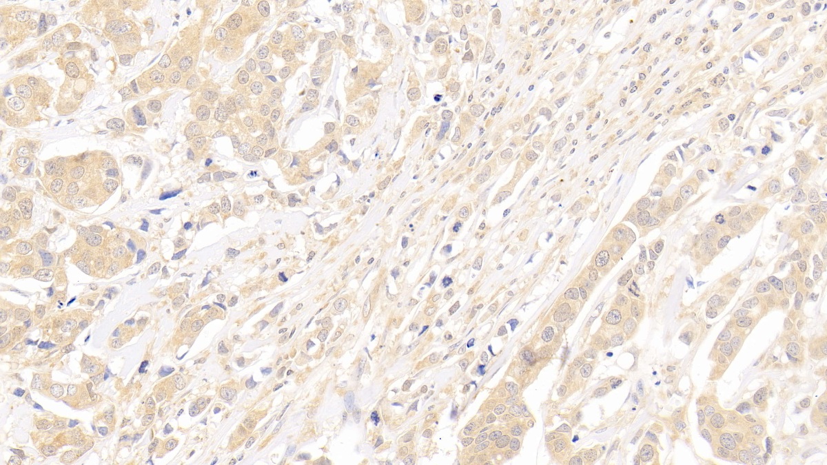 Polyclonal Antibody to Survivin (Surv)