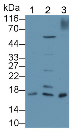 Polyclonal Antibody to Survivin (Surv)