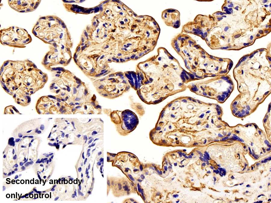 Polyclonal Antibody to S100 Calcium Binding Protein A10 (S100A10)