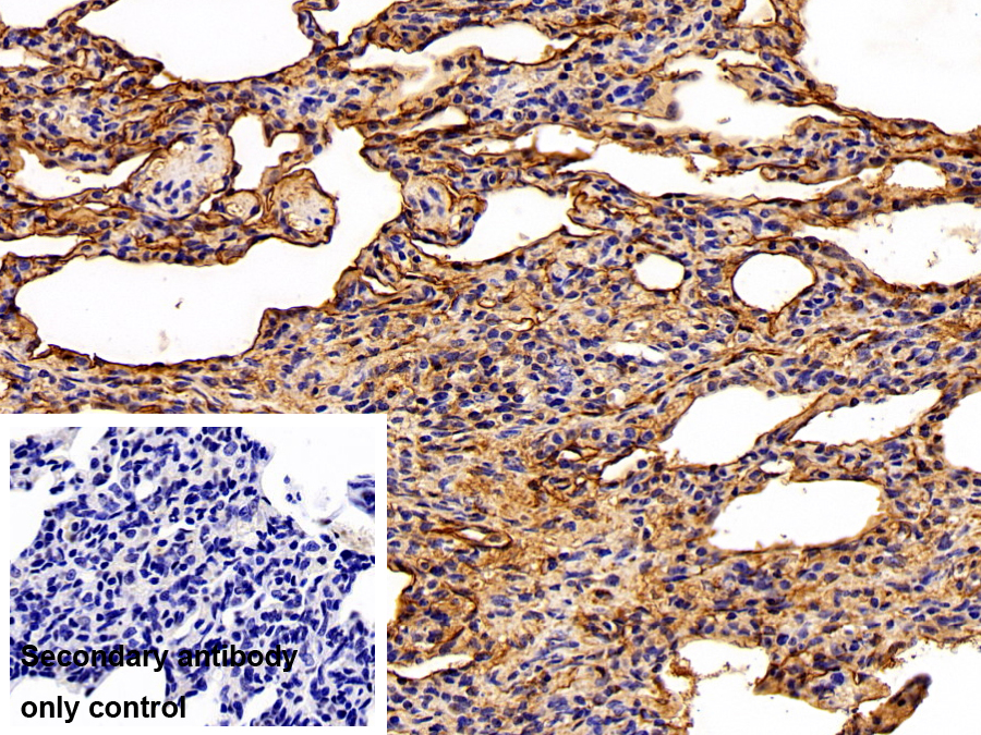 Polyclonal Antibody to S100 Calcium Binding Protein A10 (S100A10)