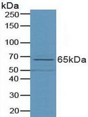 Polyclonal Antibody to Phospholipase D (PLD)