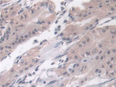 Polyclonal Antibody to Phospholipase D (PLD)