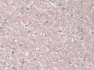 Polyclonal Antibody to Phospholipase D (PLD)