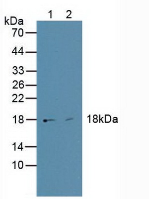 Polyclonal Antibody to High Mobility Group AT Hook Protein 1 (HMGA1)