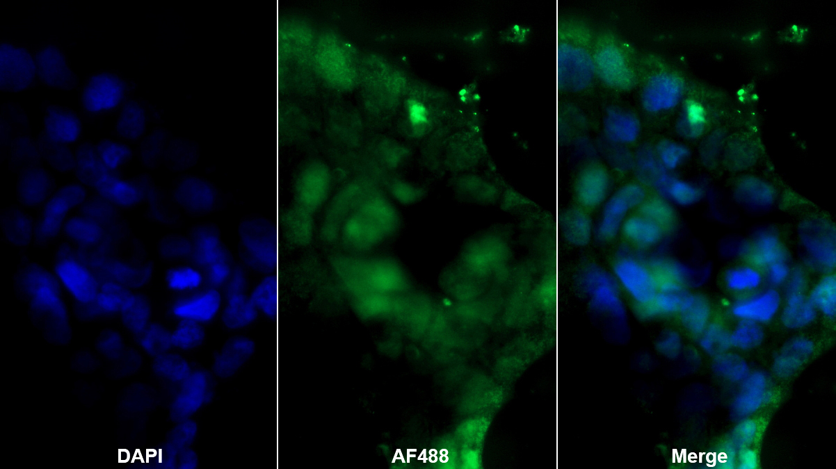 Polyclonal Antibody to High Mobility Group Box Protein 2 (HMGB2)