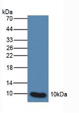 Polyclonal Antibody to S100 Calcium Binding Protein P (S100P)