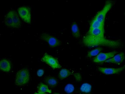 Polyclonal Antibody to S100 Calcium Binding Protein P (S100P)