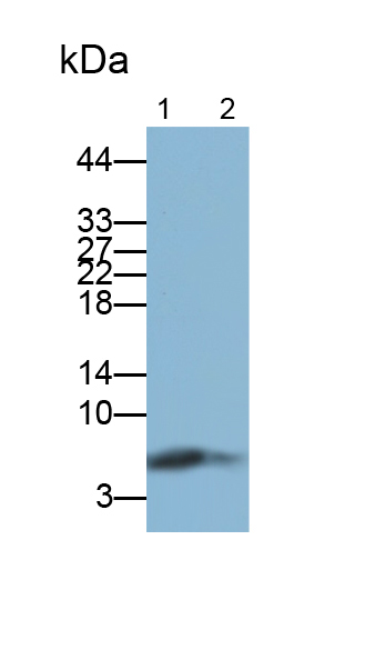 Polyclonal Antibody to S100 Calcium Binding Protein P (S100P)