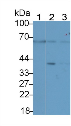 Polyclonal Antibody to Matrix Metalloproteinase 14 (MMP14)