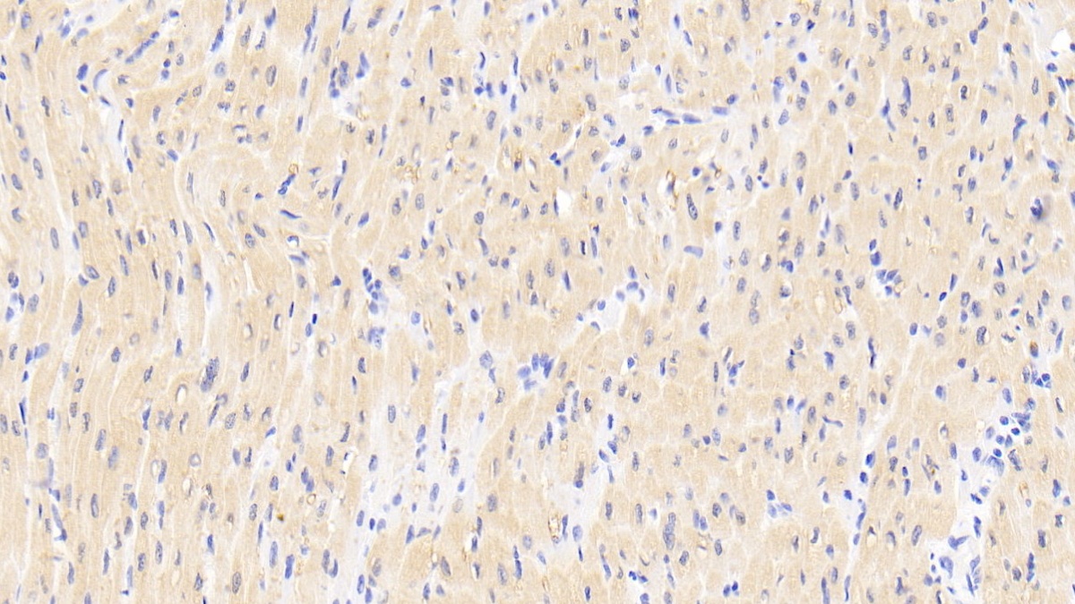 Polyclonal Antibody to Receptor Activator Of Nuclear Factor Kappa B (RANk)