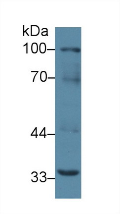 Polyclonal Antibody to Receptor Activator Of Nuclear Factor Kappa B (RANk)