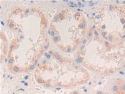 Polyclonal Antibody to Interleukin 20 (IL20)