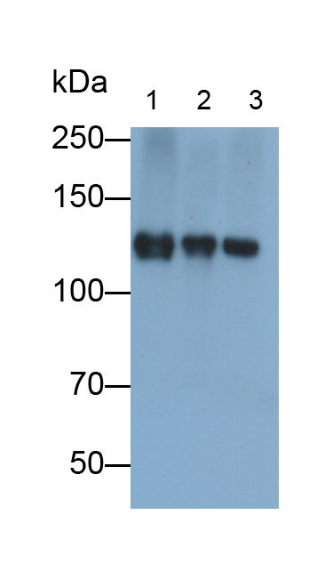 Polyclonal Antibody to Platelet Derived Growth Factor Receptor Alpha (PDGFRa)