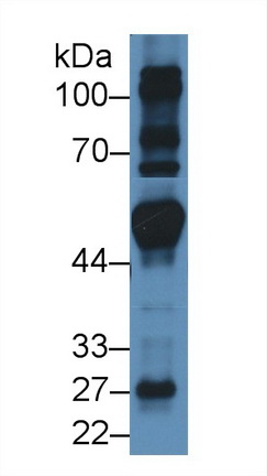 Polyclonal Antibody to Fibroblast Growth Factor Receptor Substrate 2 (FRS2)