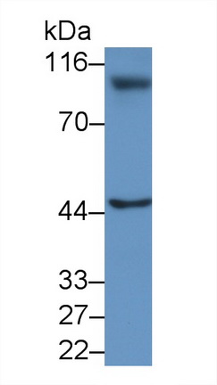 Polyclonal Antibody to Hyaluronan Mediated Motility Receptor (HMMR)