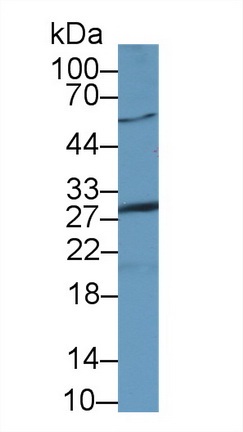 Polyclonal Antibody to Asialoglycoprotein Receptor 2 (ASGR2)