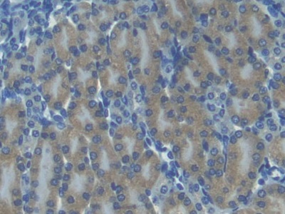 Polyclonal Antibody to Interferon Inducible T-Cell Alpha Chemoattractant (ITaC)