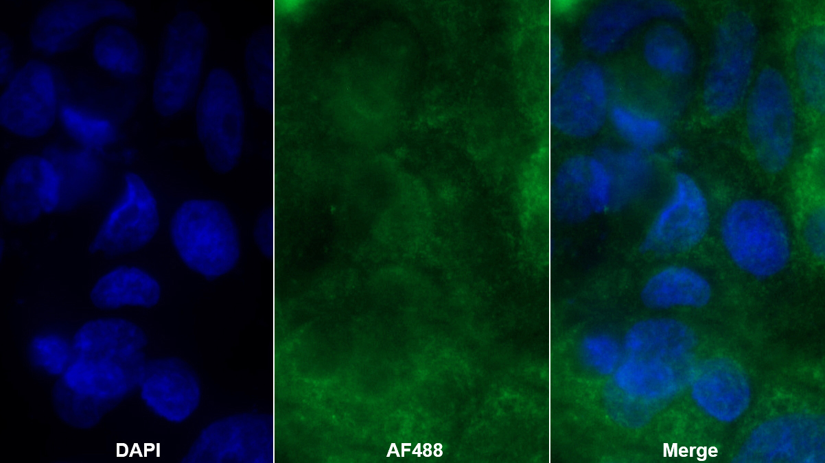 Polyclonal Antibody to Laminin Alpha 3 (LAMa3)