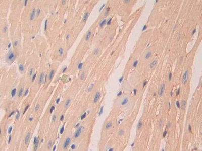 Polyclonal Antibody to Laminin Alpha 4 (LAMa4)