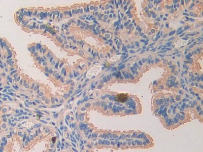 Polyclonal Antibody to Laminin Alpha 4 (LAMa4)