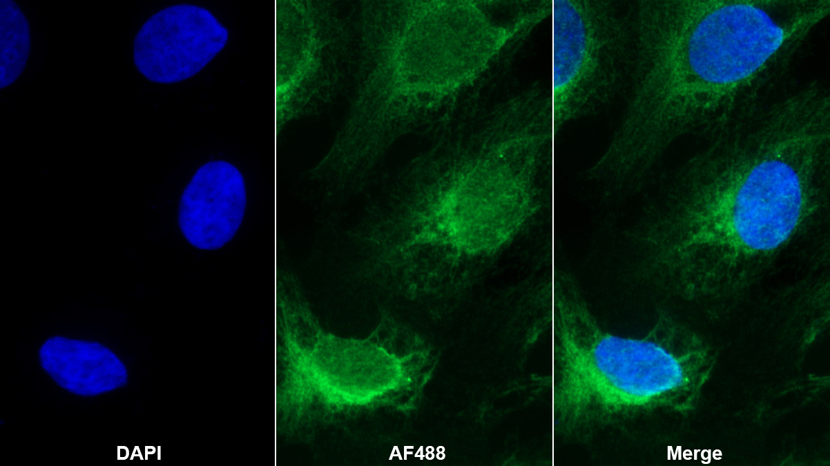 Polyclonal Antibody to Laminin Alpha 4 (LAMa4)