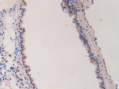 Polyclonal Antibody to Laminin Alpha 4 (LAMa4)