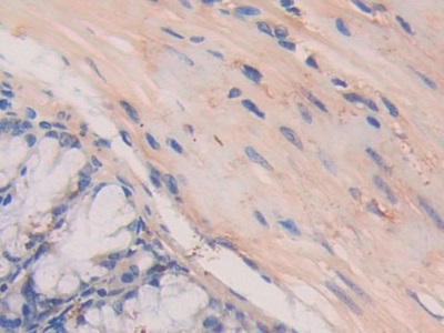 Polyclonal Antibody to Laminin Alpha 4 (LAMa4)