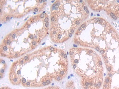 Polyclonal Antibody to Laminin Beta 2 (LAMb2)