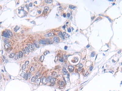 Polyclonal Antibody to Laminin Beta 2 (LAMb2)