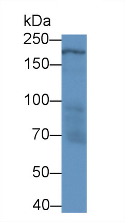 Polyclonal Antibody to Laminin Beta 2 (LAMb2)