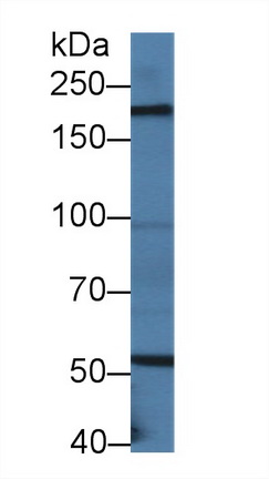 Polyclonal Antibody to Laminin Beta 2 (LAMb2)