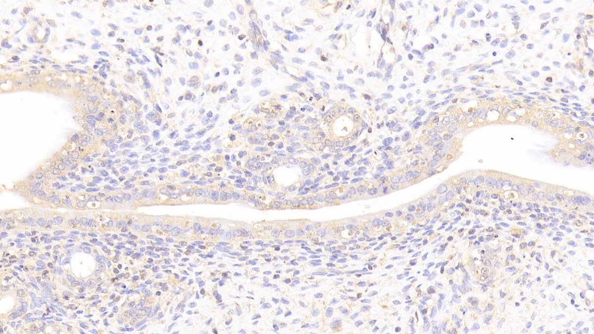 Polyclonal Antibody to Laminin Beta 2 (LAMb2)