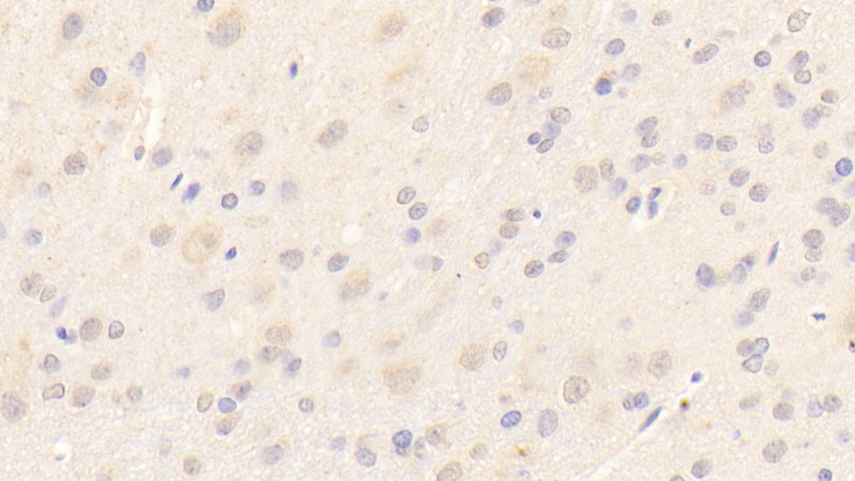 Polyclonal Antibody to Laminin Beta 2 (LAMb2)