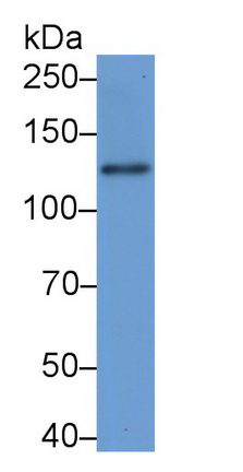 Polyclonal Antibody to Laminin Beta 3 (LAMb3)