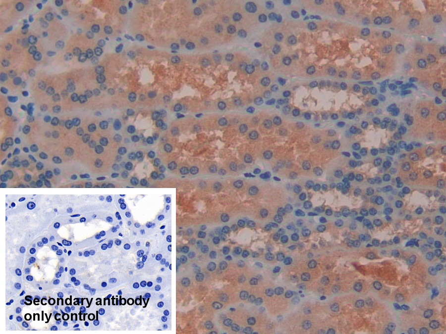 Polyclonal Antibody to Laminin Beta 3 (LAMb3)